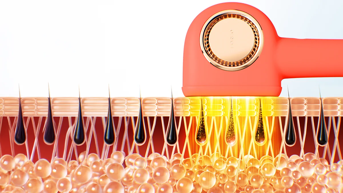 at home laser hair removal devices acting on hair root depiction